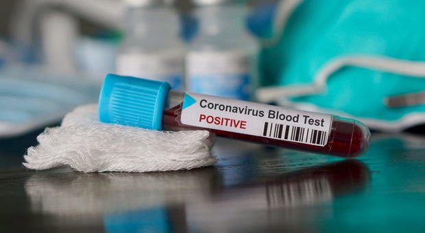 Coronavirus, incredibile nel foggiano: «Contagi incontrollati» ai funerali di un 75enne positivo