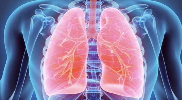 A Pisa si effettua la cura del tumore al polmone con uno trattamento innovativo