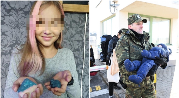 Ucraina, 16 bambini uccisi nella guerra con la Russia: da Polina morta in auto ad Alisa uccisa dalle bombe