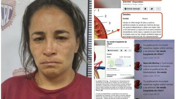 «Vendo il rene di una 15enne, il prezzo è 20mila dollari»: donna arrestata dopo l'annuncio sul web