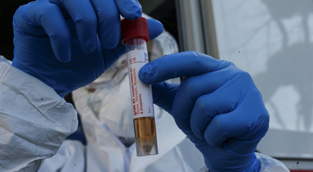 Coronavirus, un test del sangue per capire prima chi avrà bisogno del ricovero in terapia intensiva