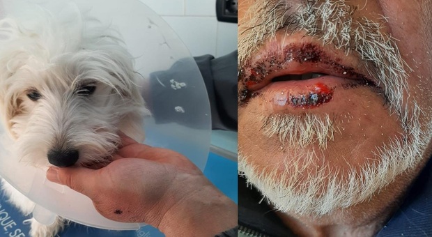 Turisti bergamaschi aggrediti da un pitbull in spiaggia: ferito l'uomo e il suo cagnolino. La coppia insultata dal padrone del molosso