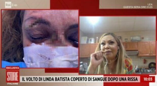 Linda Batista a Storie Italiane racconta l'aggressione: «Colpita in faccia col tacco di una scarpa»